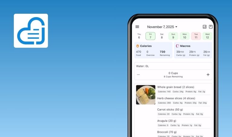 Anomalies détectées dans Journable : compteur de calories par IA pour iOS